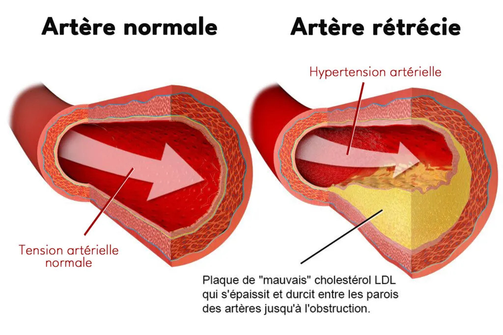santé éducation